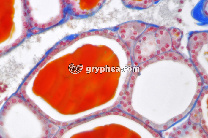 Thyroïde x160 - gryphea.com